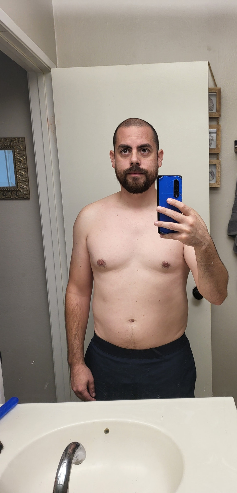 Andrew before coaching with Rebuild Fitness